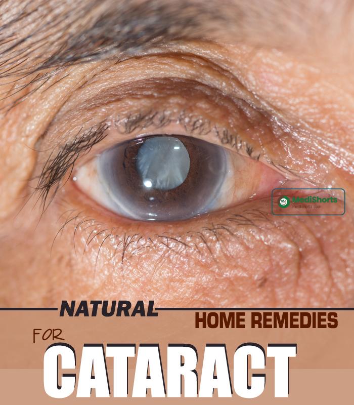 Remedies To Cure Cataract