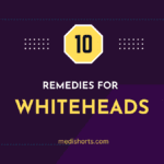 Home Remedies For Whiteheads