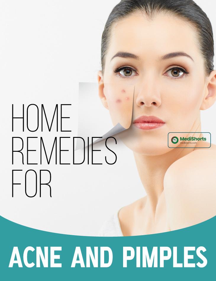 Home Remedies for Acne and Pimples 2