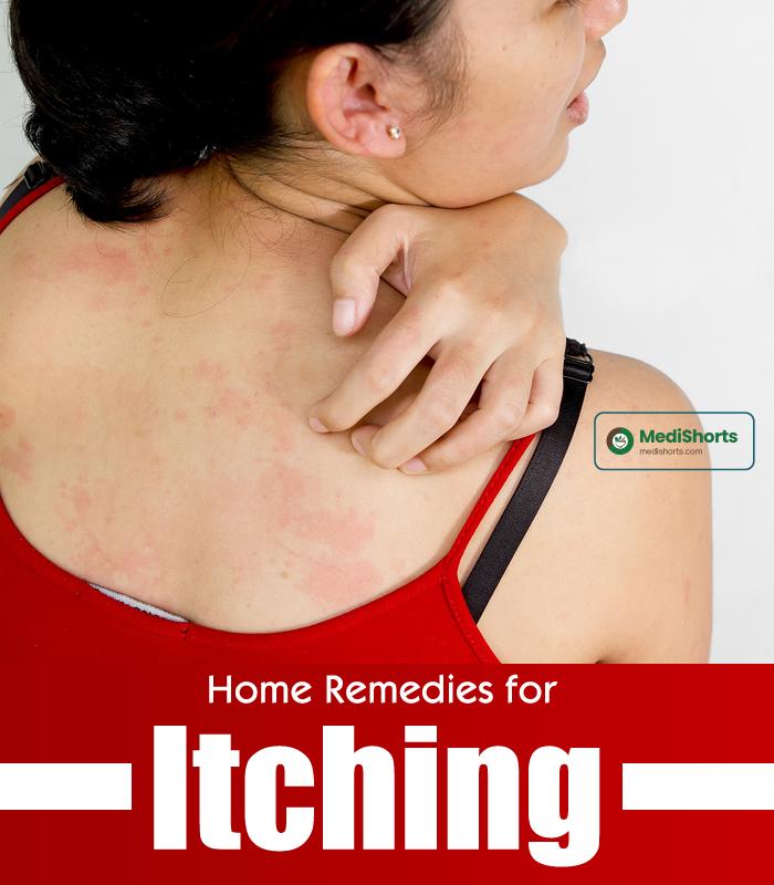 Itching remedies