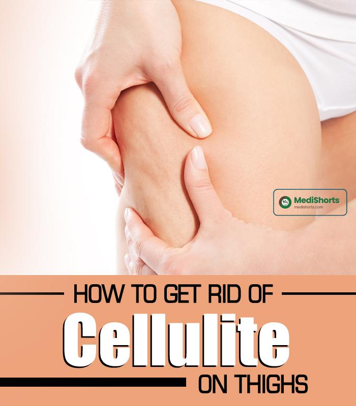 How to Get Rid of Cellulite on Thighs