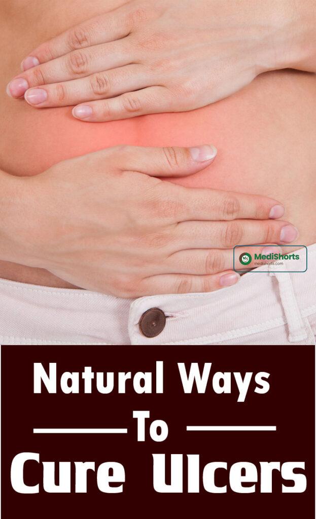 Natural Ways To Cure Ulcers