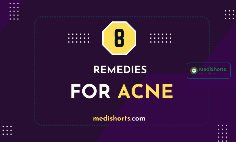 REMEDIES for ACNE
