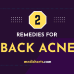 back acne remedies