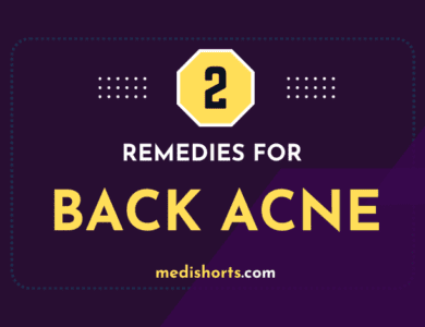 back acne remedies