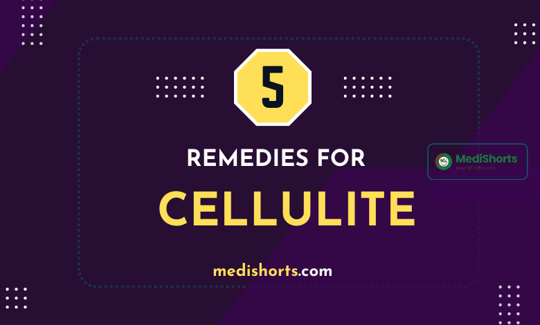Remedies for Cellulite