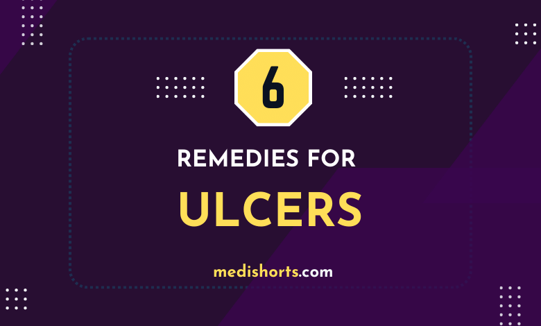 Remedies for Ulcers
