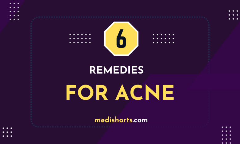 Herbal Remedies for Acne
