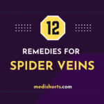 Spider Veins Natural Remedies